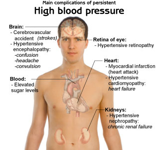 High Blood Pressure 3